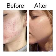 The INKEY List Niacinamide Serum 30ml